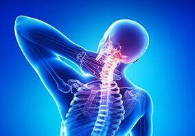 Probable consequences with a junction of osteocondrosis