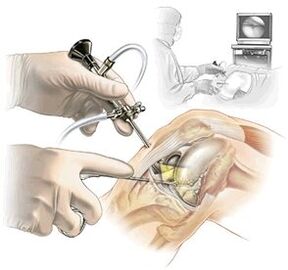 Clarification of diagnosis of dash medicine arthros