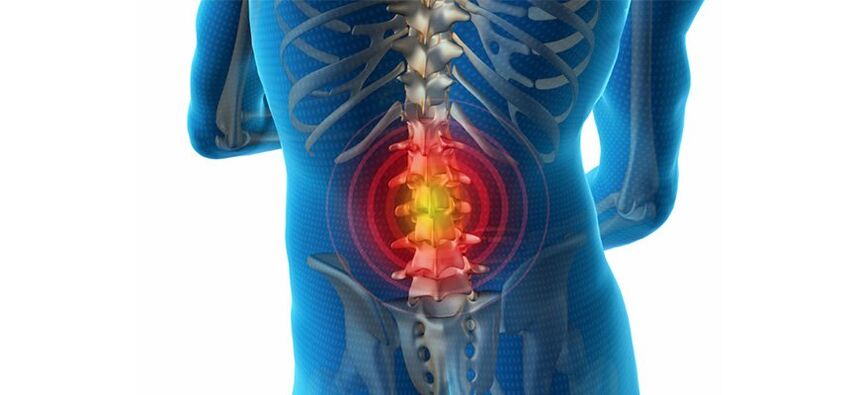 methods of diagnosis of back pain